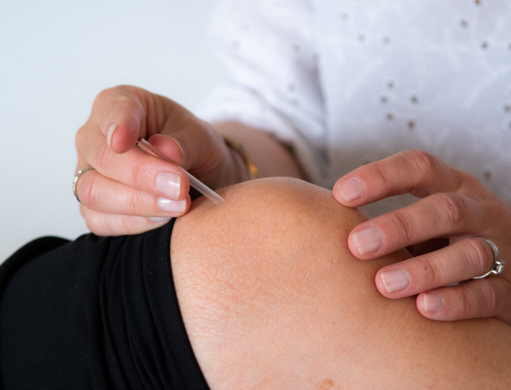 Acupuncture on the knee