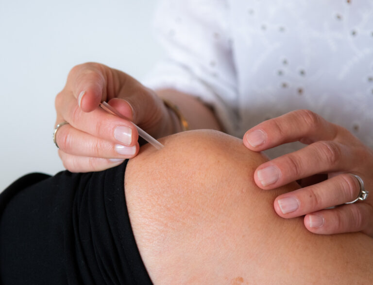 Acupuncture on the knee